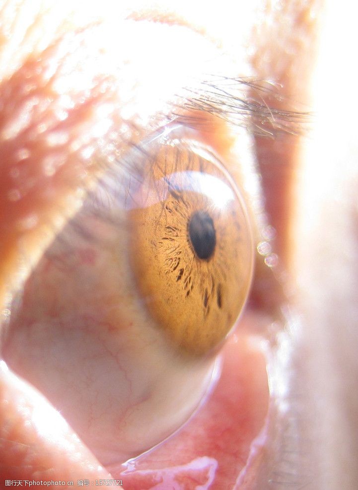 瞳孔眼科检查图片