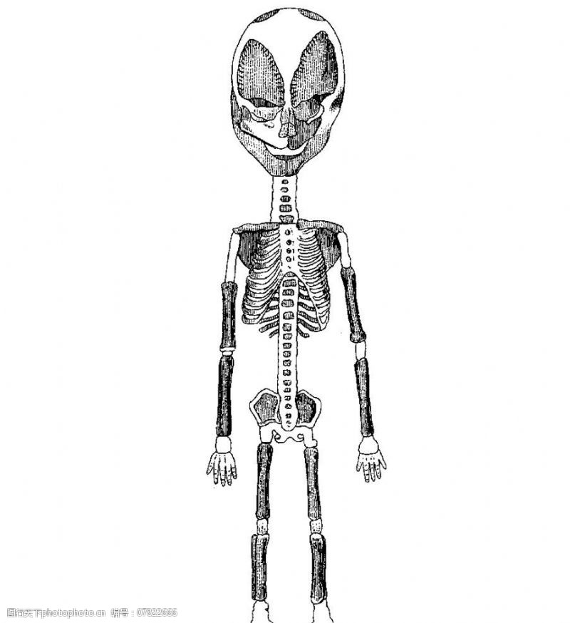 内脏儿童或外星人骨骼正面2图片
